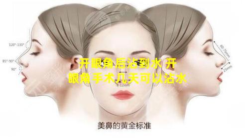 开眼角后沾到水 开眼角手术几天可以沾水
